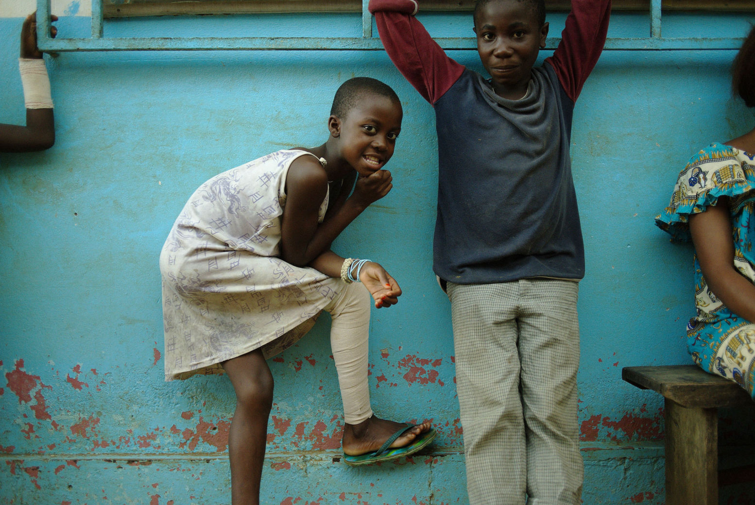 Patients of Buruli treatment centre in the rural district of Akonolinga, Cameroon. Photo by Marcell Nimfuehr.