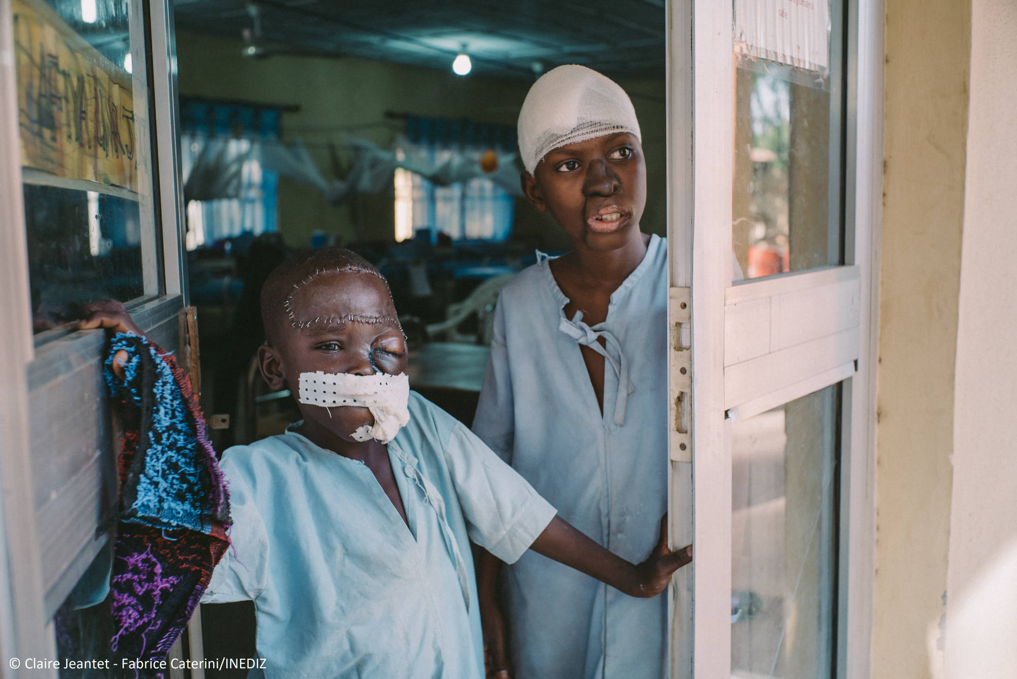 Umar, an eight-year-old noma patient from Kano state, and Adamu, a 15-year-old noma patient from Kebbi state, stand at the entrance of the post-operative ward at the Sokoto Noma Hospital. Photo by Claire Jeantet - Fabrice Caterini/INEDIZ.