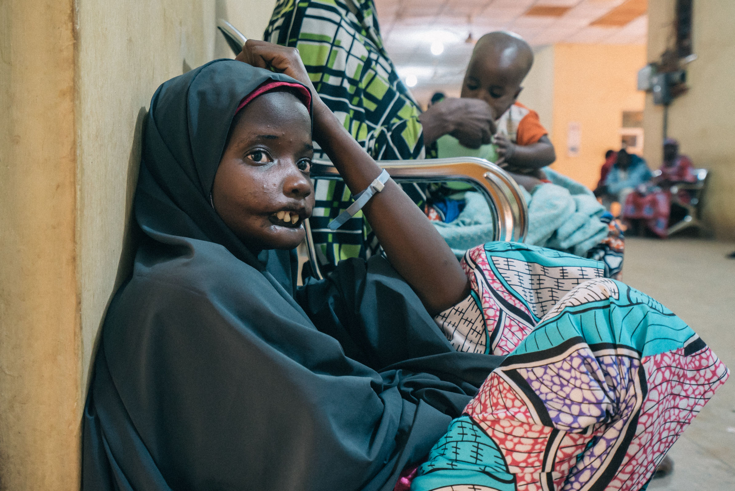 Amina, an 18-year-old noma patient from Yobe state, in the Sokoto Noma Hospital. Photo by Claire Jeantet - Fabrice Caterini/INEDIZ.
