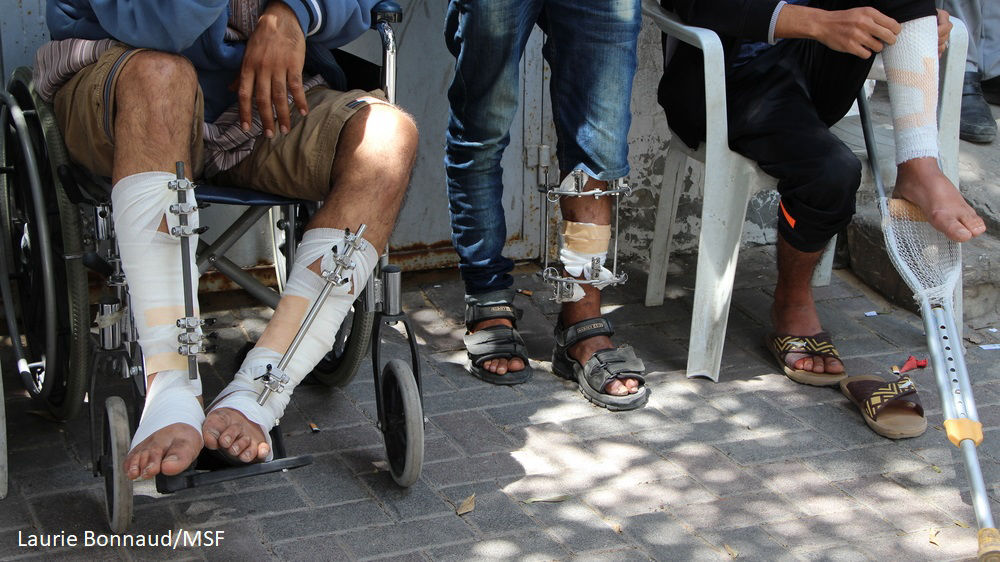 Les jambes des patients blessés par balle au cours de la March de retour, attendant devant une clinique à Gaza. Fauteuil roulant, fixateur externe et béquilles. L'âge moyen des patients est de 25 ans et les blessures leur laisseront des conséquences à long terme.
