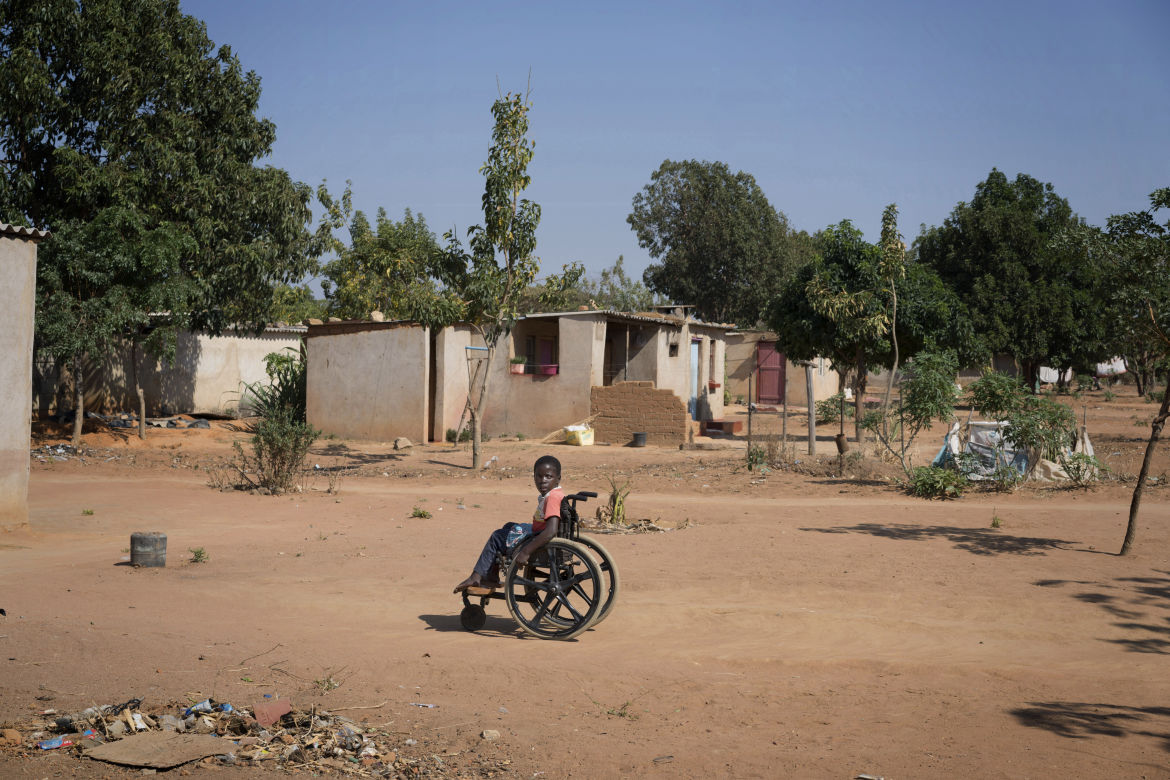 Tanya a dix ans et est incapable de marcher. On lui a diagnostiqué le VIH alors qu'elle n'avait que quelques mois. Zimbabwe.