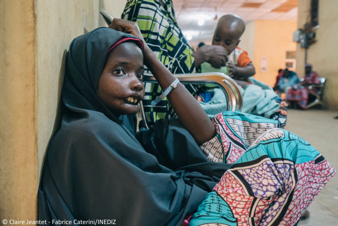 Amina, an 18-year-old noma patient from Yobe state, in the Sokoto Noma Hospital. Photo by Claire Jeantet - Fabrice Caterini/INEDIZ.