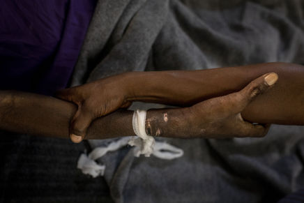 Un patient avec un VIH avancé pris en charge dans le Centre Hospitalier de Kabinda à Kinshasa. Le patient a été diagnostiqué séropositif en 2010. En juin 2019, il a été hospitalisé pour la première fois. Quelques semaines plus tard, il a dû être réadmis en urgence. Photo par Pablo Garrigos.